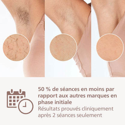 Philips Lumea série 8000, Épilateur à lumière pulsée, alternative à l'épilation laser, technologie SenseIQ, 4 accessoires pour le corps, le visage, le maillot et les aisselles, modèle BRI948/00